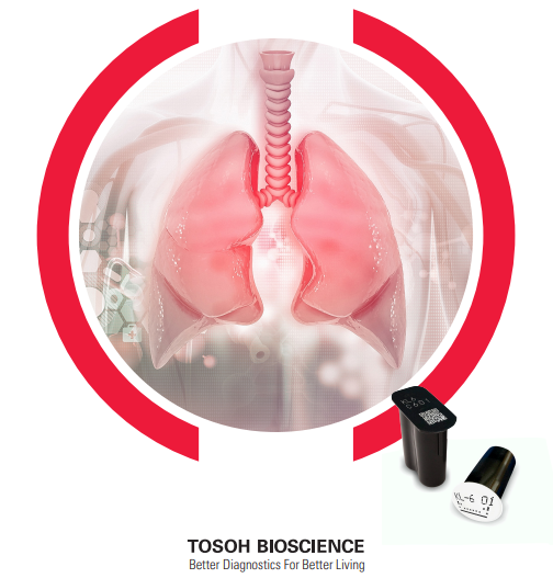 KL-6  A Marker for the Monitoring of Patients with Interstitial Lung Disease